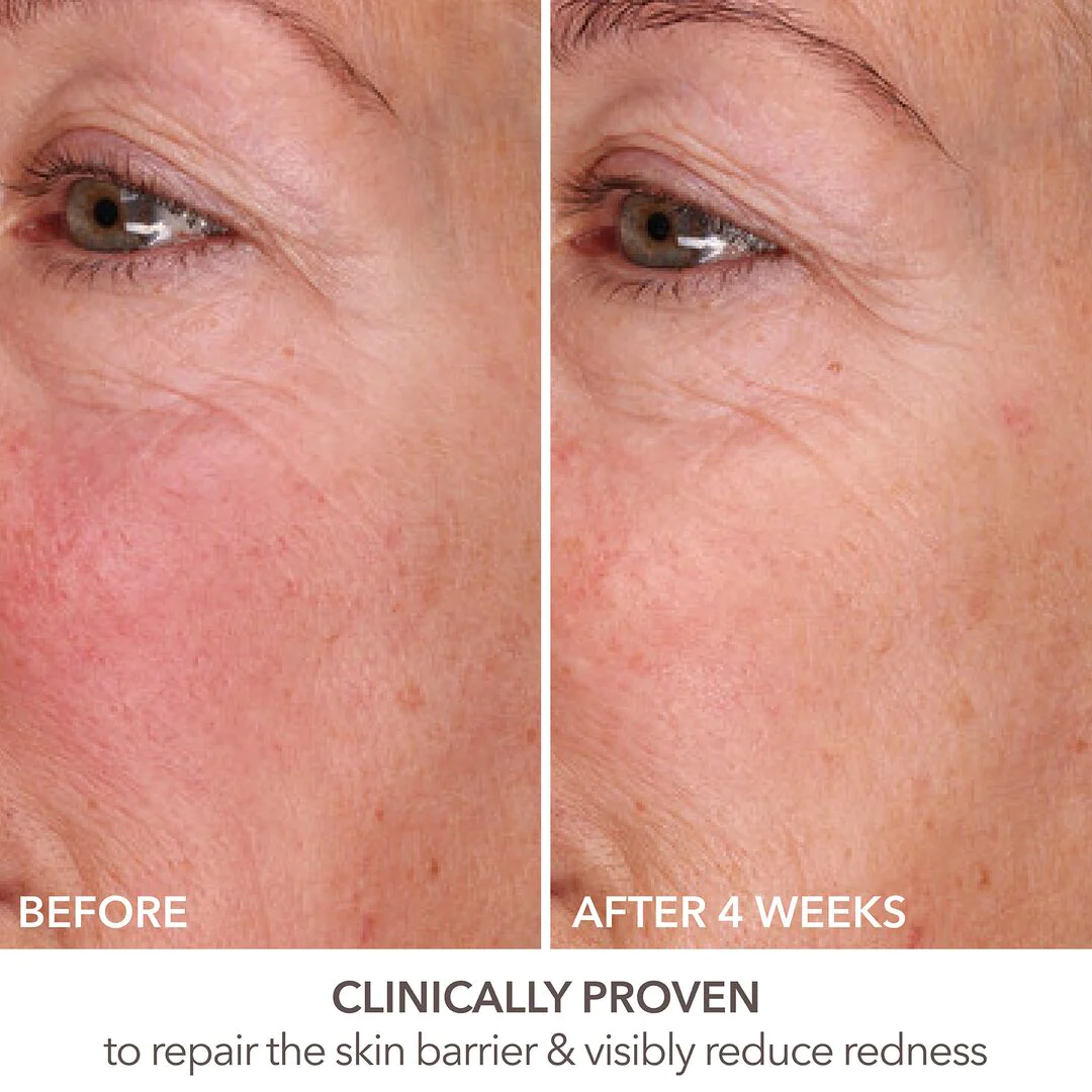 Dr Dennis Gross DermInfusion Fill + Repair Serum - Bilde 9