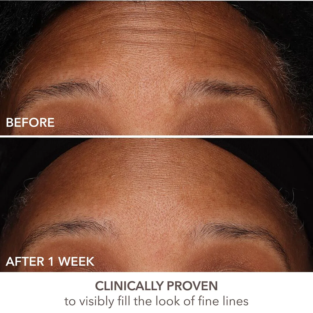 Dr Dennis Gross DermInfusion Fill + Repair Serum - Bilde 4